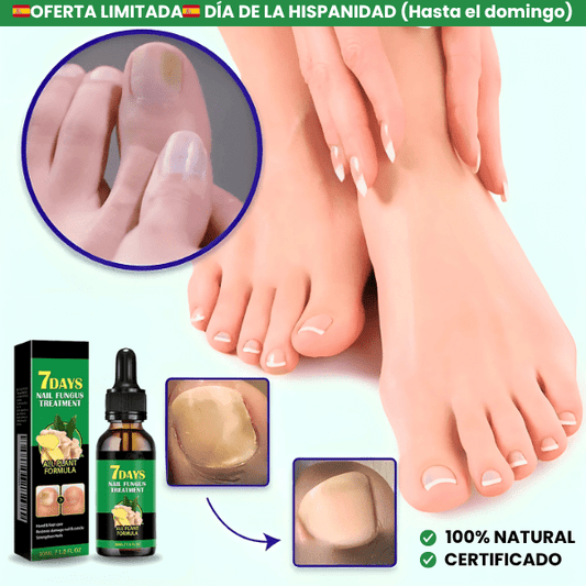 TRATAMIENTO ANTI-HONGOS 7 DÍAS 100% NATURAL
